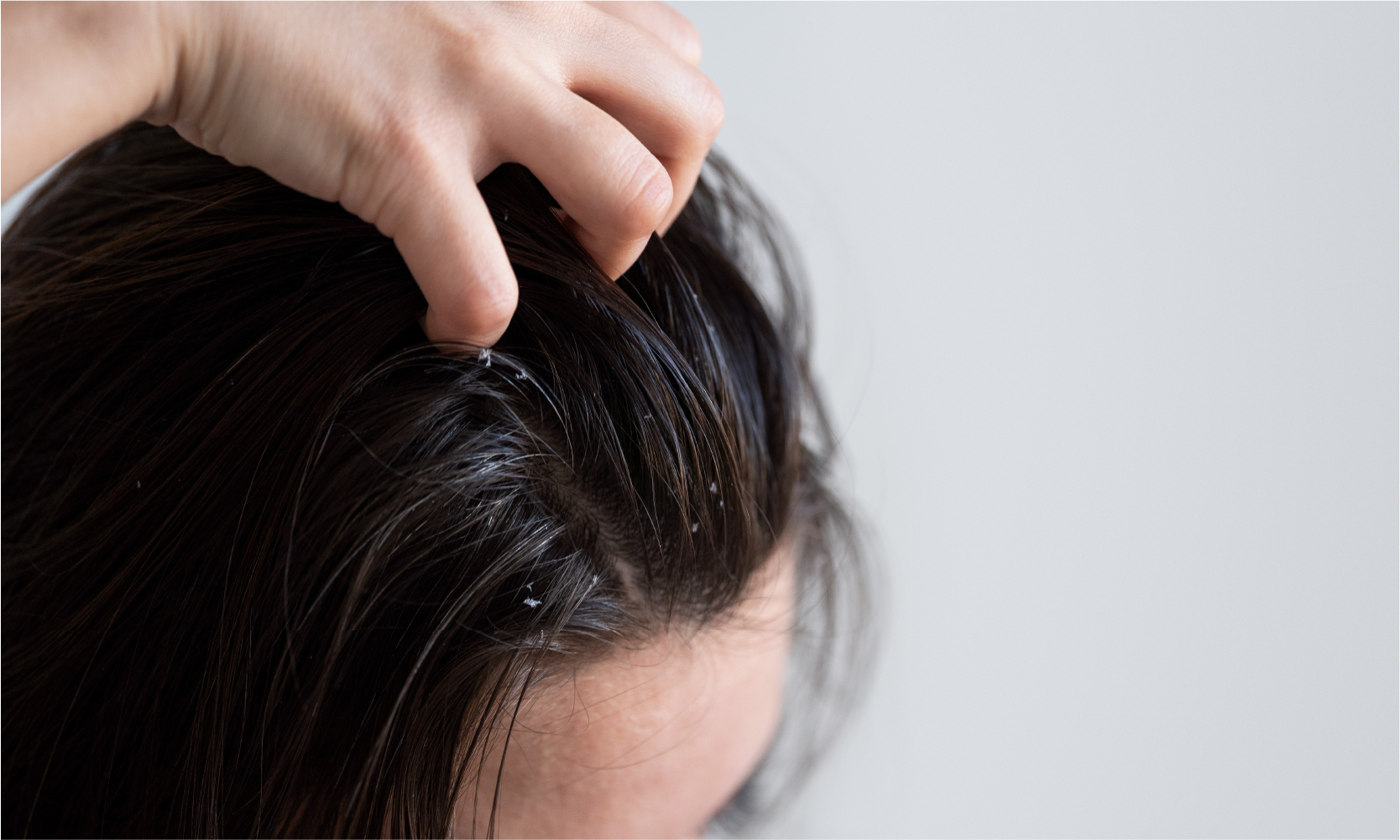 5 Reasons Your Scalp Itches and How to Get Relief